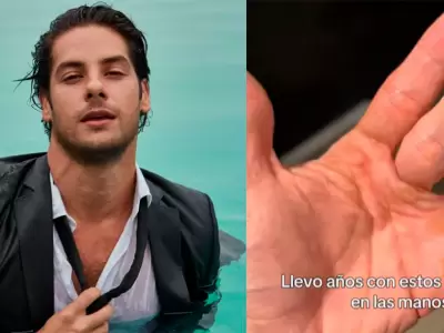 Actor Andr�s Wiese comparti� im�genes de sus calambres.