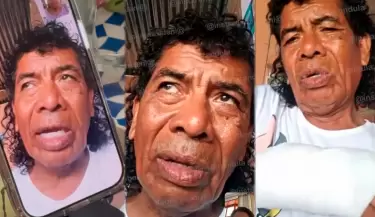 Cachay rompe su silencio tras agresi�n en show en Lambayeque.