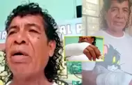 Cachay queda fracturado tras agresi�n y operaci�n costar�a S/25 mil: "No puedo mover los dedos"