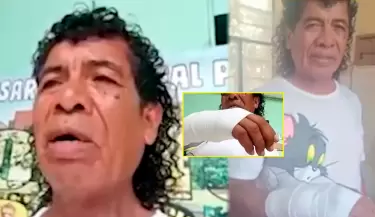 Cachay revela que operaci�n tras agresi�n costar�a S/25 mil.