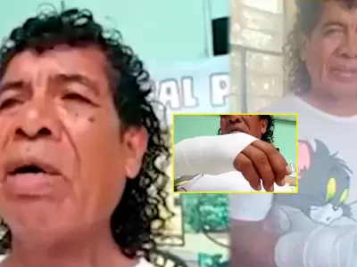 Cachay revela que operaci�n tras agresi�n costar�a S/25 mil.