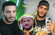 Mario Irivarren se habr�a sometido a un nuevo retoquito en el rostro: "Es la versi�n de John Travolta jalado"